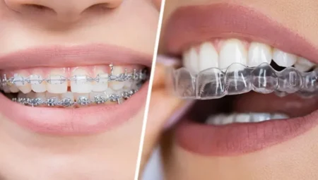 İzmir Ortodonti Uzmanı